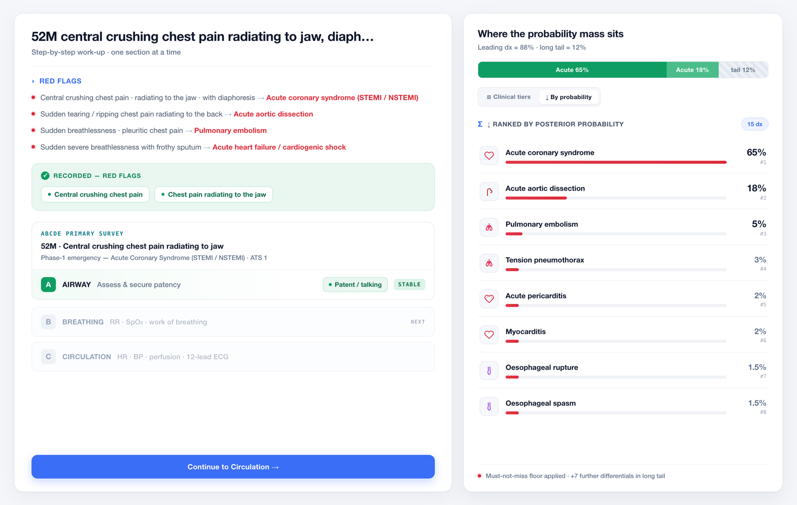 Diagnify clinical decision support interface showing a structured work-up, red flags and a ranked differential diagnosis.